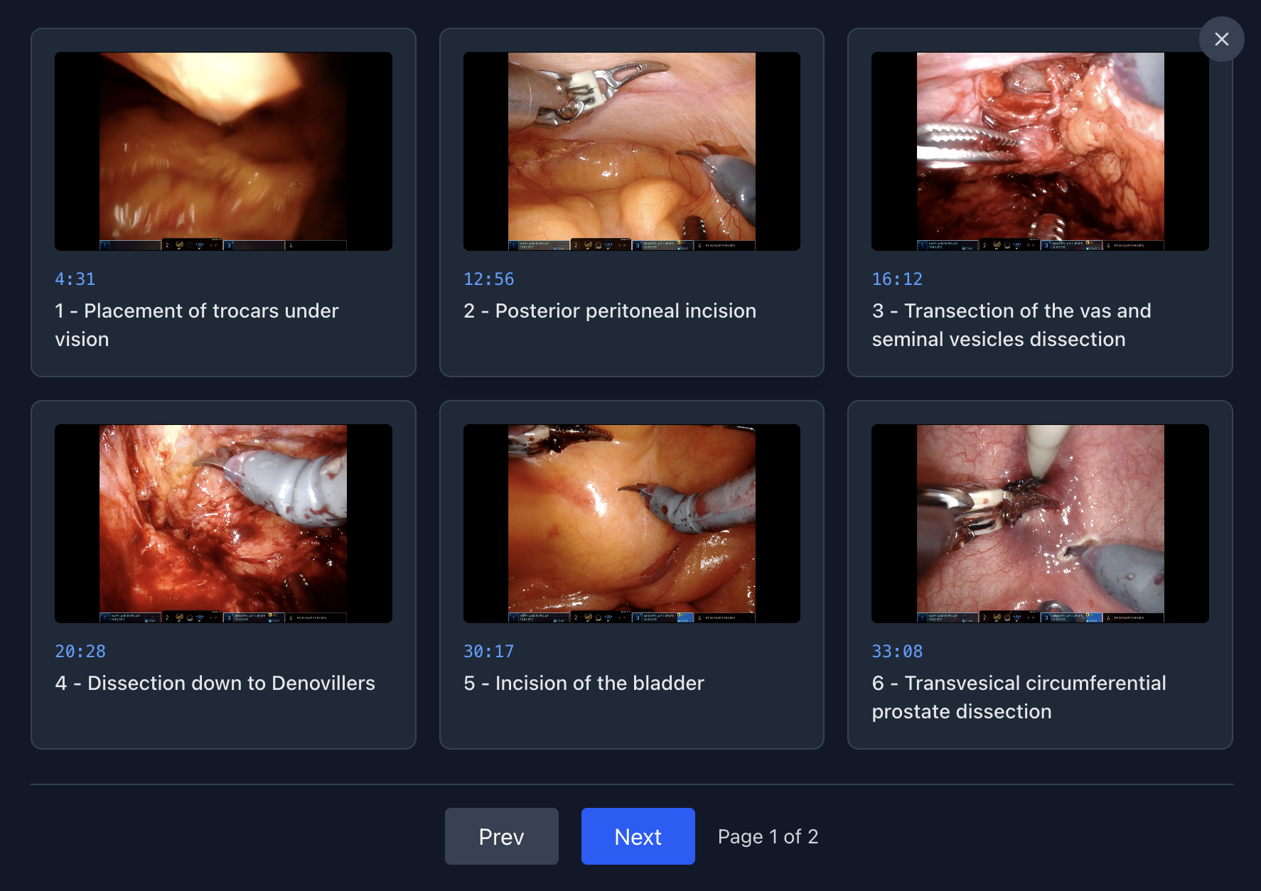 InOperis case review interface showing annotated surgical footage